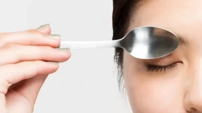 Estetik operasyonlara alternatif doğal güzellik tekniği