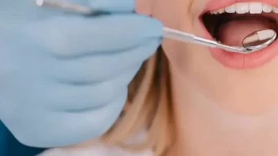 Damak yarasına iyi gelen 6 doğal çözüm