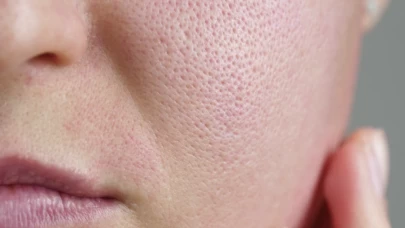 Gözeneklere savaş aç! Yağla temizlik, cam gibi cilt!