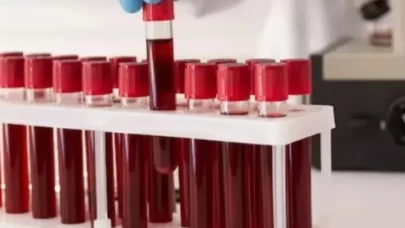 Siz hangi kan grubuna sahipsiniz? Yapay zeka onları "Tembel" olarak etiketledi