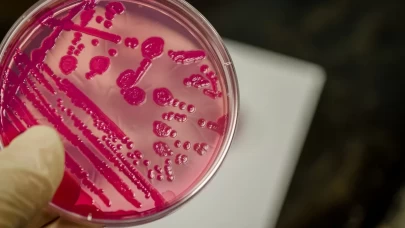 Salmonella bakterisinin üremesi için bahar ve yaz ayları elverişli