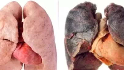 Sigara dumanını akciğerlerinizden atmak için sabahları mutlaka tüketmeniz gereken besinler