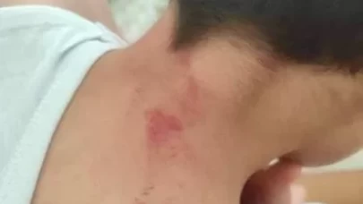 Öğrenciye feci darp! Öğretmen tutuklandı!