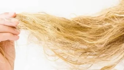 Boyadan yanan saçlar nasıl kurtarılır?