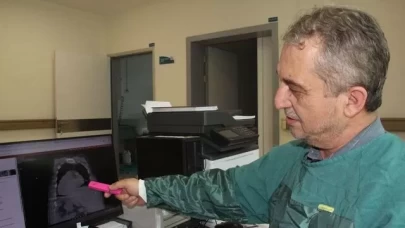 Karadeniz sendromu nedir? Giresun’dan tıp dünyasına yeni tanı