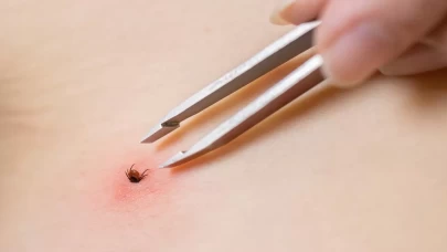 Sıcaklar başladı, kene vakaları arttı