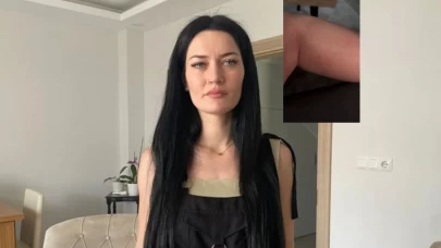 Solaryumda mahsur kaldı, yanıklar oluştu...