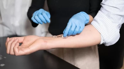 Enfeksiyonları günler öncesinden tespit eden akıllı bandaj