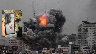 5 Yaşındaki Usame’nin öncesi ve sonrası fotoğrafları tüm dünyayı sarstı