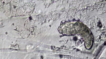 Siz uyurken yüzünüzde yaşayan canlılar iş başında olabilir