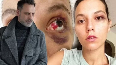 Ozan Güven'e hapis cezası