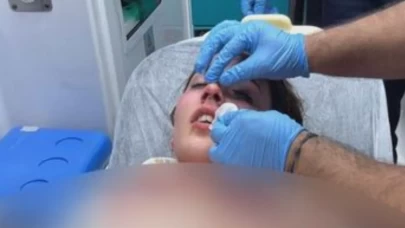 Tatil için gitti, nişanlısından şiddet gördü!