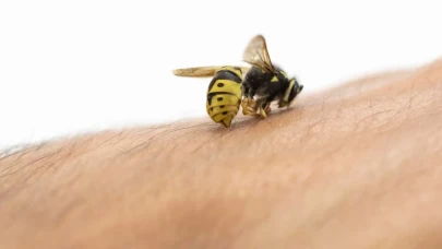 Arı sokması öldürür mü? İbni Sina’dan arı sokmasına birebir tarif!