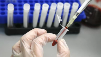 HIV tedavisinde tarihi adım!