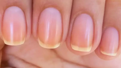 Ojeden sararan tırnaklara doğal çözüm: Evde kolayca beyazlatabilirsiniz