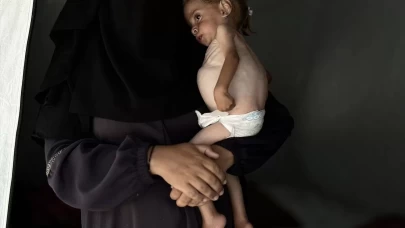 Gazze'de 2 yaşındaki Filistinli bebek yaşam mücadelesi veriyor