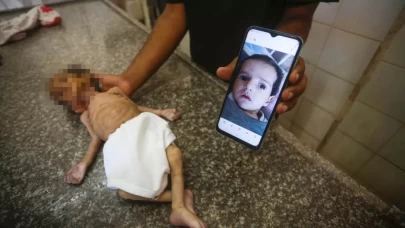 İsrail ablukası altındaki Gazze'de 3 aylık bebek Curi de açlıktan öldü