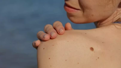 Ben aldırmak tehlikeli mi?