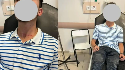 Başıboş köpeğin saldırısına uğrayan motosikletli kurye yaralandı