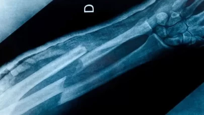 “Kemiği kırılmayanlar” teorileri gündemde!