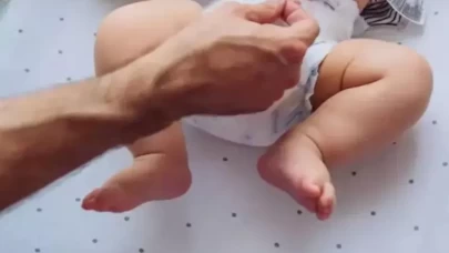 Pişik kabusu bitiyor! Bebek cildini korumanın 5 altın kuralı