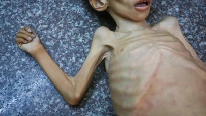 Gazze'de bir çocuk daha hayatını kaybetti