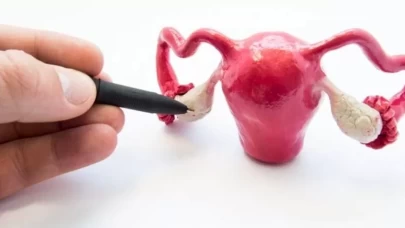 Polikistik over sendromu tehlikesi!