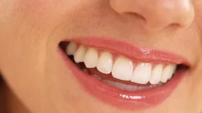 Karbonatla diş temizliği yapılır mı?