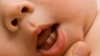 Bebeklerde diş çıkarma ağrısı ve kaşıntısına karşı etkili çözümler