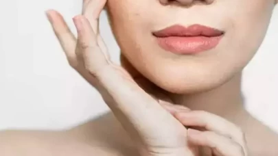 Hamilelikte cilt lekelerine karşı etkili çözümler!