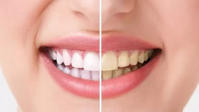 Doğal diş beyazlatma! Damla sakızıyla parıl parıl gülüşler