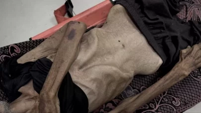 Gazze’de açlık can almaya devam ediyor!