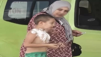 Üzerine parfüm sıkıp çakmak yakan çocuk yaralandı