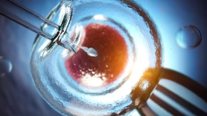 Tüp bebek süreci: Yumurta toplama (OPU) nedir?