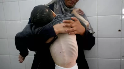 Gazze’de açlık felaketi derinleşiyor!