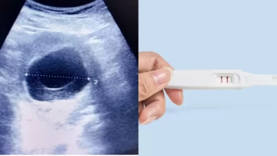 Tüp Bebek Sürecinde Yumurtalık ve Rahim Hazırlığı: Nelere Dikkat Edilmeli?