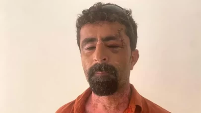 Öfkeli damat kayınpederini hastanelik etti