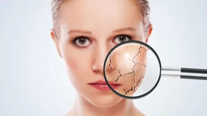 Hangi cilt tipine sahipsiniz?