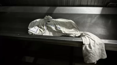 Gazze açlıktan ölüyor!