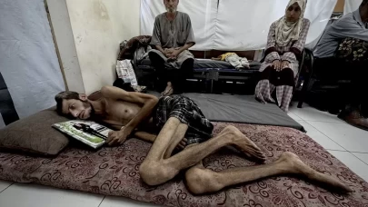 Gazze’de insani dram: Yardım peşindeki sivile İsrail kurşunu