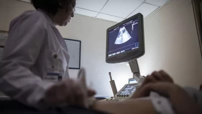 Miyom nedir, tehlikeli mi? Kadınlarda belirti vermeyen iyi huylu tümörler hakkında bilmeniz gerekenler