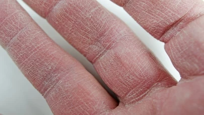 Yıl boyu yumuşacık eller! İbni Sina’dan besleyici krem önerisi