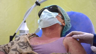 Şikayetler artınca, alarma geçildi! Güzelleşmek isterken hastanelik oldular