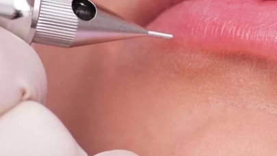 Yüz hatlarını belirginleştiriyor, kalıcı güzellik sağlıyor