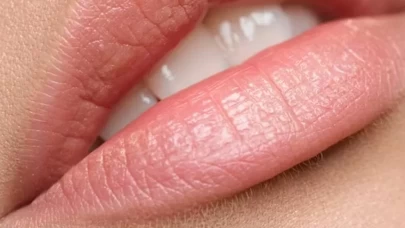 Dudaklarınız için en iyi 6 doğal bakım ürünü