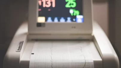 Hamilelikte NST (Non-Stres Test) Nedir?