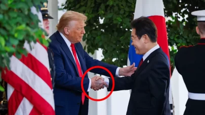 Donald Trump'ın elindeki morluk dikkat çekti!