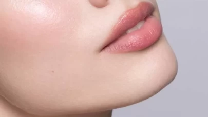 Kış aylarında dudaklarınızı yumuşacık tutmanın 3 etkili yolu