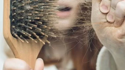 Yanlış beslenme ve stres gençlerde saç dökülmesini tetikliyor