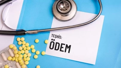 Ödem Attıran Yiyecekler: Ödem İçin Beslenme Rehberi